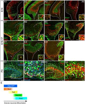 Differentiation stage-specific expression of transcriptional regulators for epithelial mesenchymal transition in dentate granule progenitors